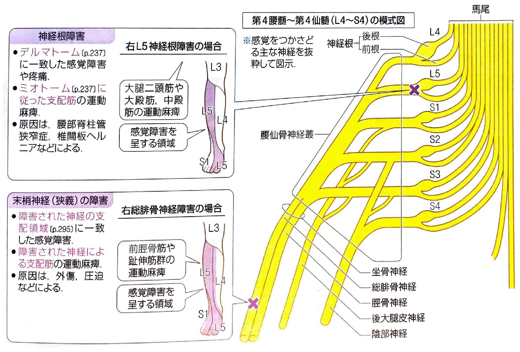 腰部脊柱管狭窄症に対する鍼灸治療